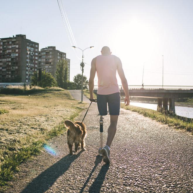 man with prosthetic leg walking his dog